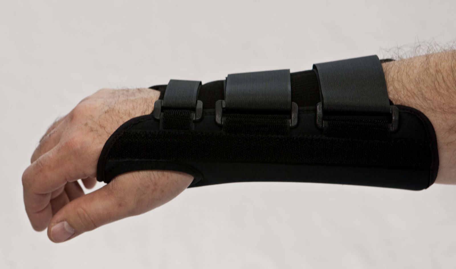 Wrist Hand Orthosis (WHO)